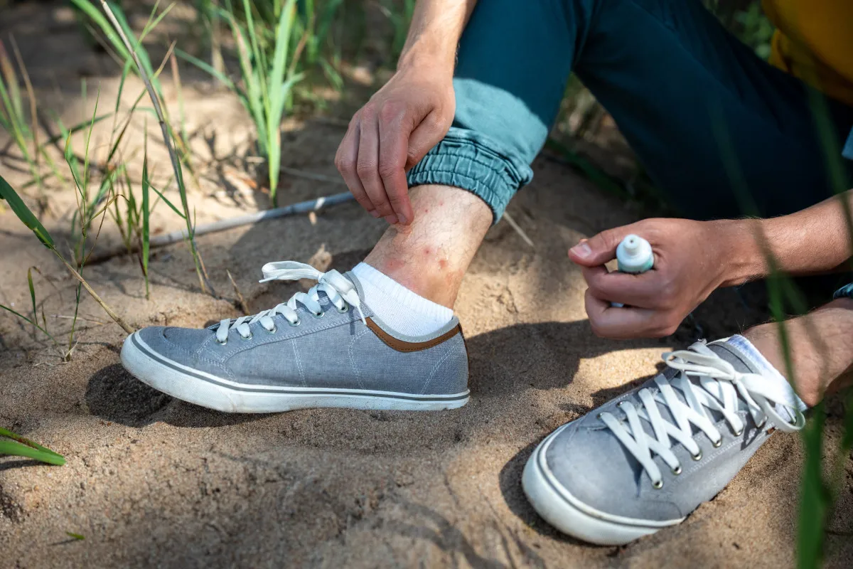 preparez-lete-prochain-installez-une-moustiquaire-pour-des-nuits-paisibles